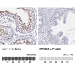 DMRTB1 Antibody, Novus Biologicals:Antibodies:Primary Antibodies